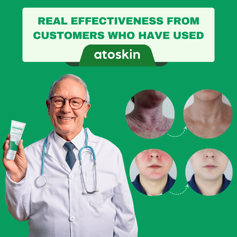 Atoskin Skin Recovery Cream 30g - Krim Eczema, Psoriasis, ekzema, Tidak Mengandungi Corticoid