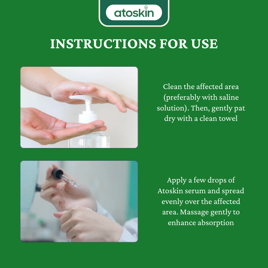 Atoskin Skin Recovery Cream 30g - Krim Eczema, Psoriasis, ekzema, Tidak Mengandungi Corticoid