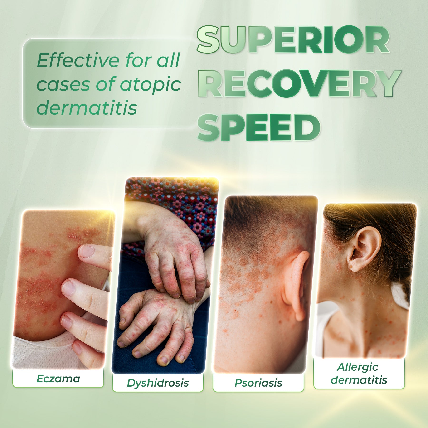 ATOSKIN Serum - Kurangkan kegatalan, psoriasis & ekzema – 7 Hari Nampak Perubahan