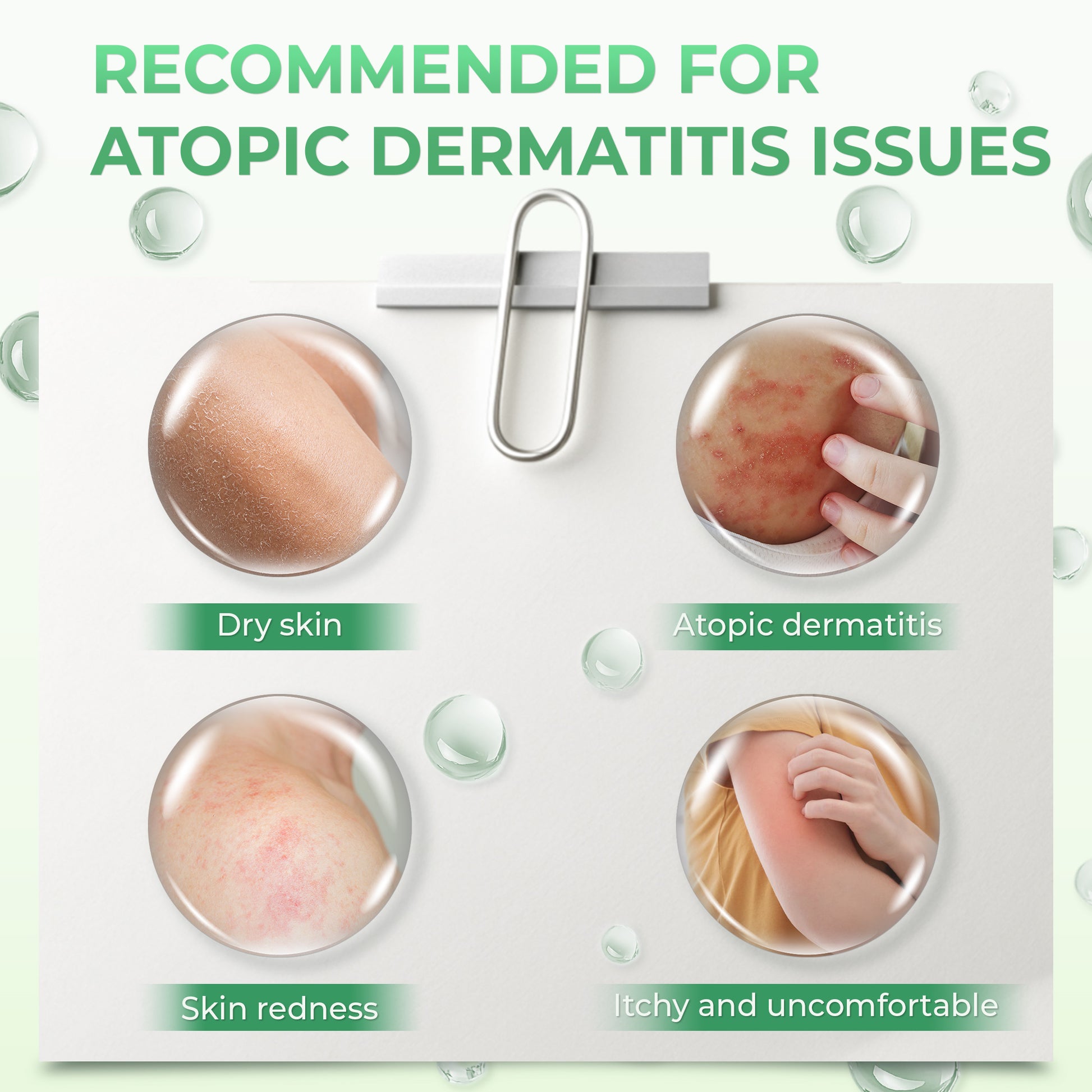 Gel Mandian Eczema Atoskin Atopic - Menyokong pembersihan kulit, ekzema - 200ml