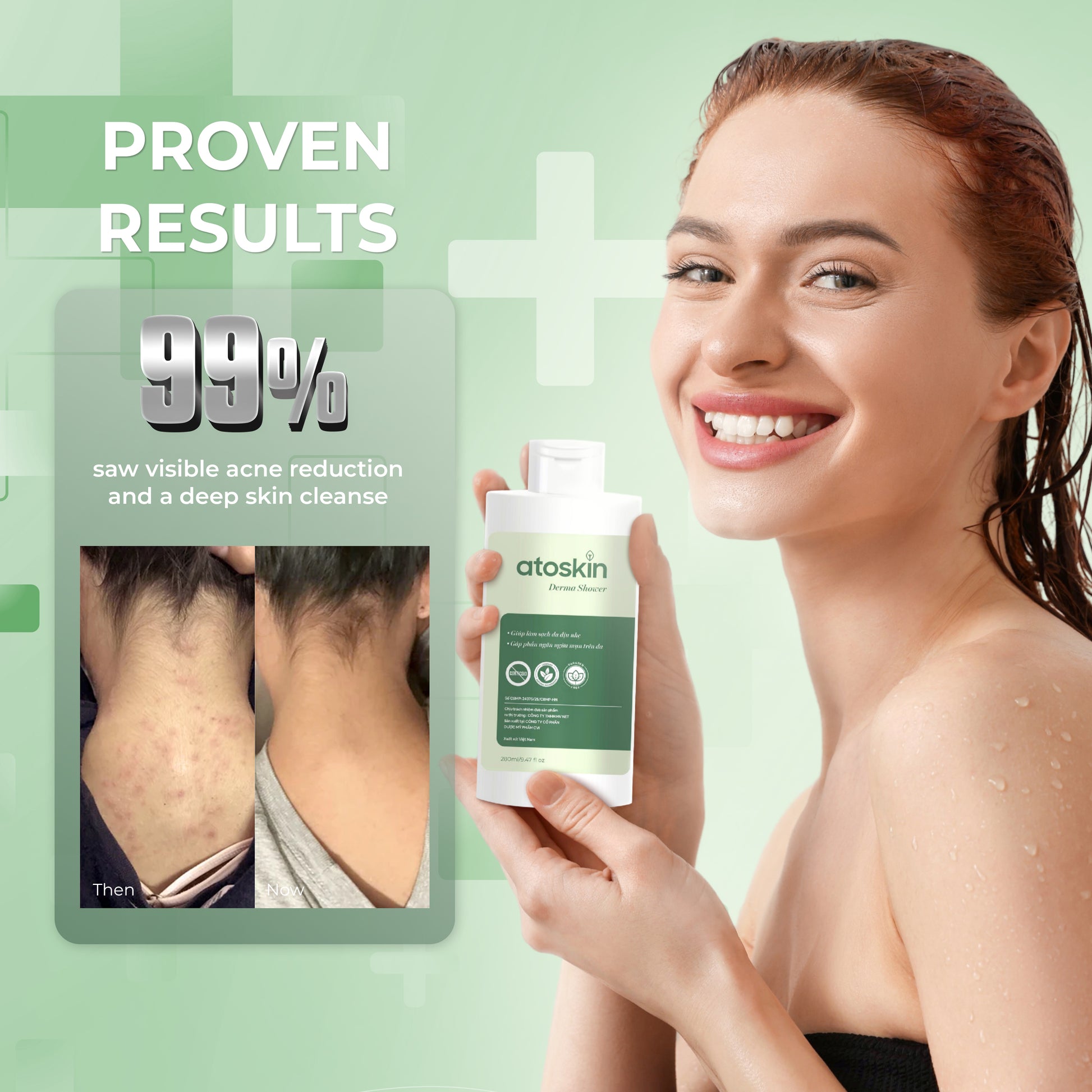 Mandian Jerawat Belakang ATOSKIN 280ml – Bersih, Kurang Minyak & Bantu Pulih Jerawat