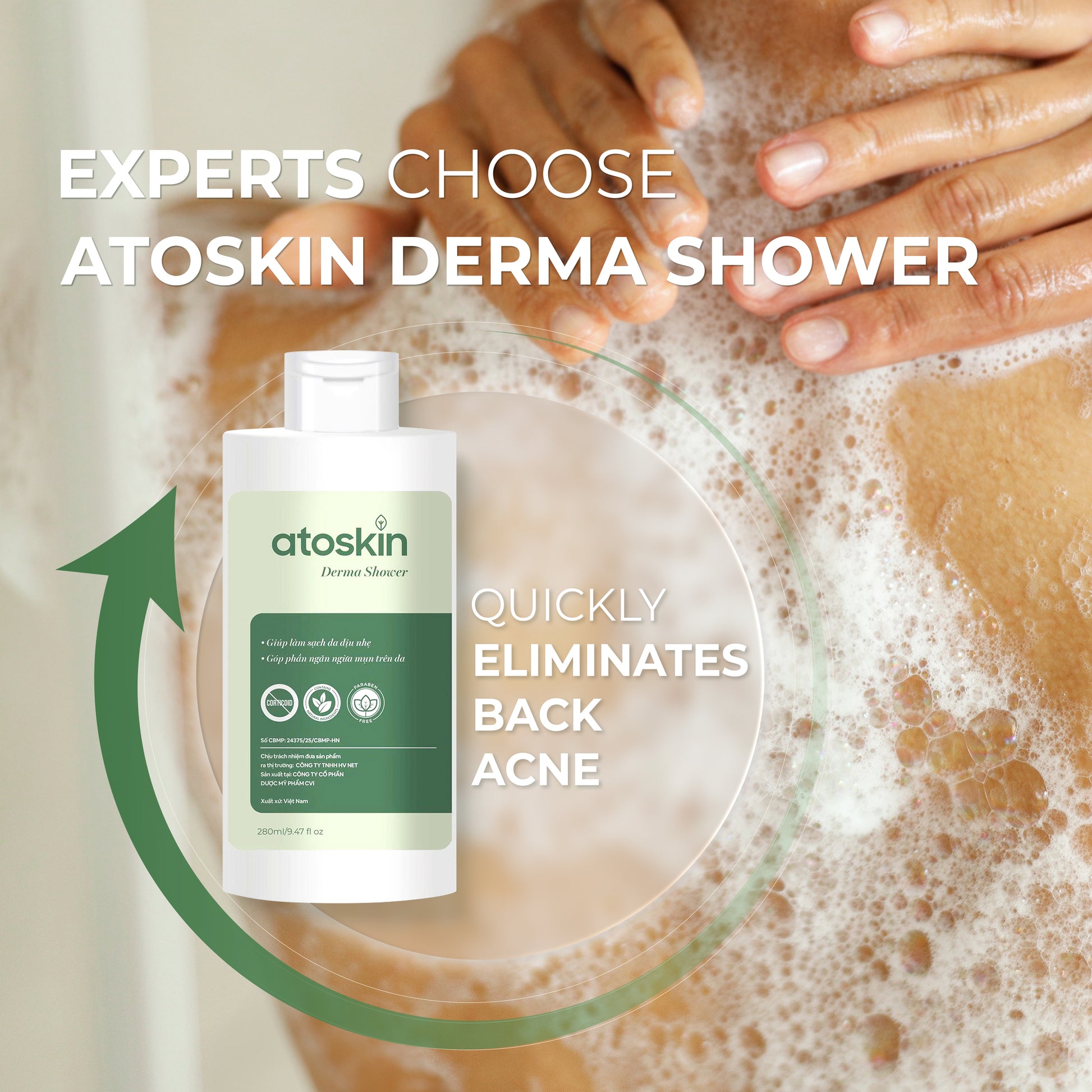 Mandian Jerawat Belakang ATOSKIN 280ml – Bersih, Kurang Minyak & Bantu Pulih Jerawat