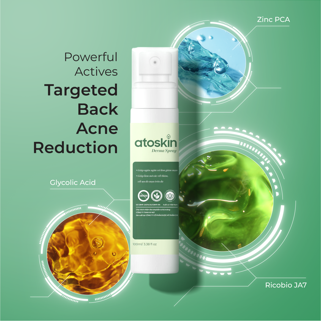Semburan Jerawat Belakang ATOSKIN 100ml – Bersih, Kurang Jerawat & Pulih Kulit