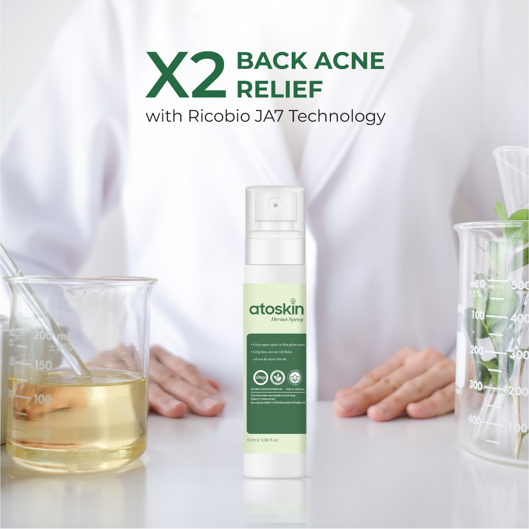 Semburan Jerawat Belakang ATOSKIN 100ml – Bersih, Kurang Jerawat & Pulih Kulit